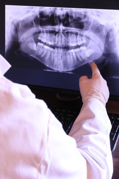 Best Emergency Wisdom Teeth Removal in Petaluma, CA