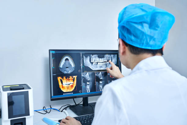 Best Emergency Tooth Extraction in Petaluma, CA